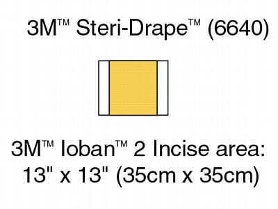 ioban6640.jpg