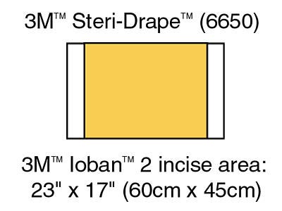 ioban6650.jpg